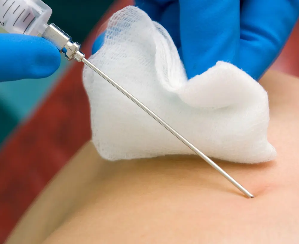 biopsja tarczycy-wezłów-chłonnych-medici-radzionkow