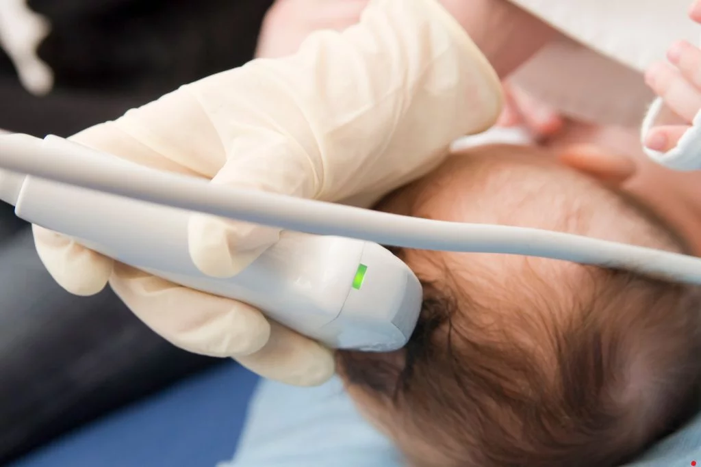 USG-Przezciemiaczkowe-centrum-medyczne-medici-radzionkow