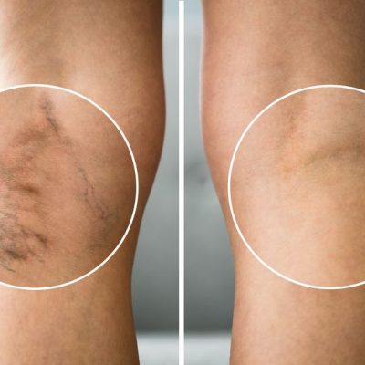 doppler-tetnic-konczyn-dolnych-centrum-medyczne-medici-radzionkow