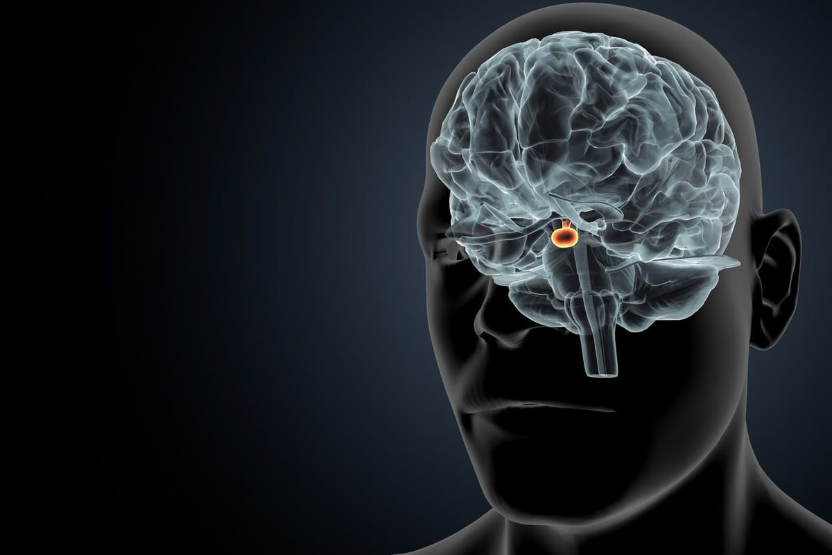 przysadka-guz-neurochirurg-neurolog-centrum-medyczne-medici-radzionkow-slaskie