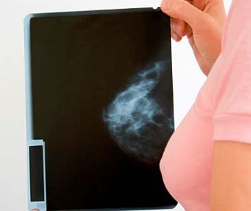 usg-piersi-z-elstografią-centrum-medyczne-medici-radzionkow