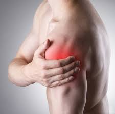 Zapalenie kaletki barkowej